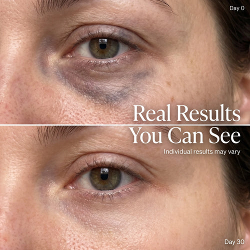 Eye Bag Renewal Device