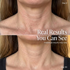 Neck Renewal Therapy Band