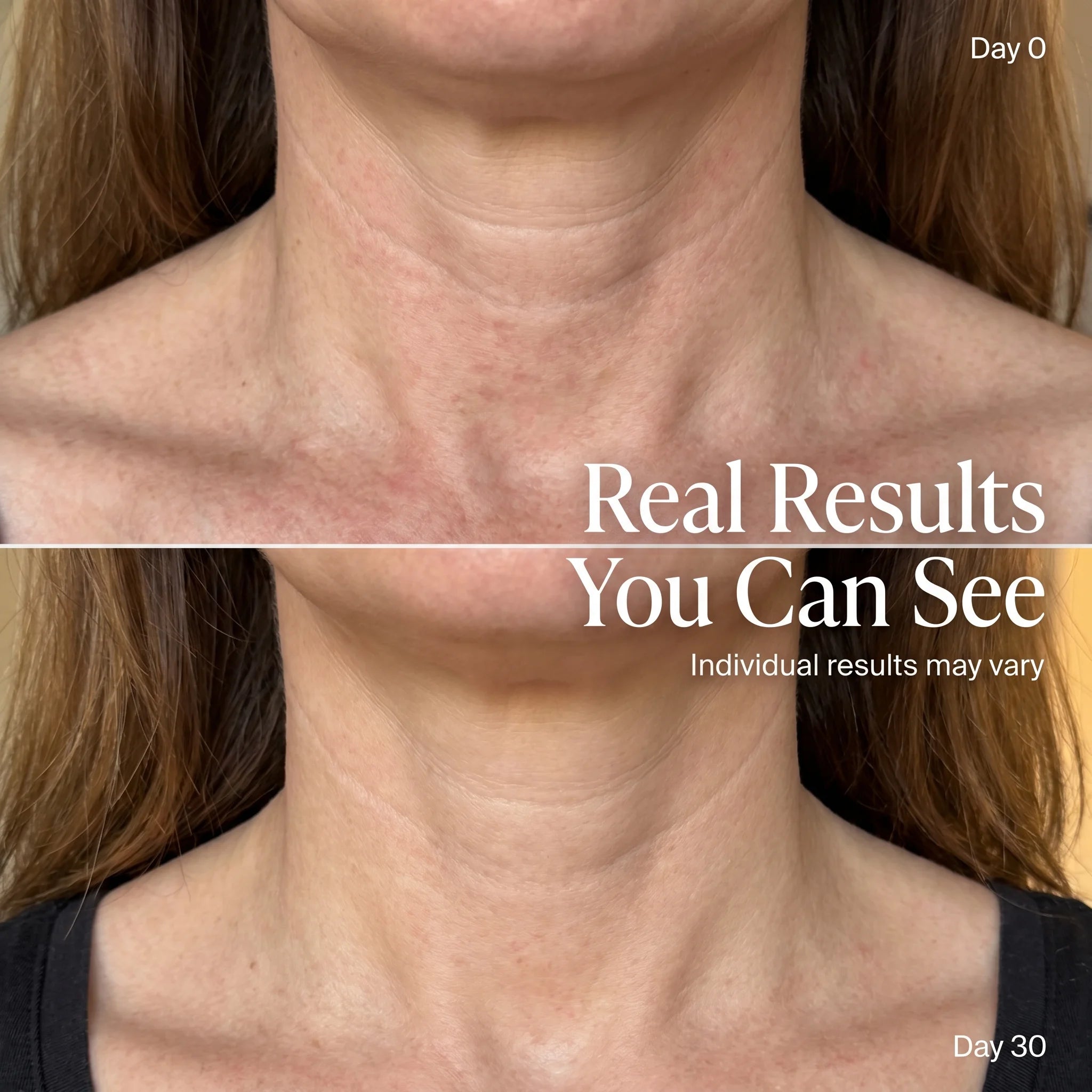 Neck Renewal Therapy Band