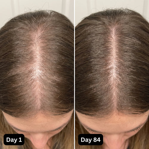 Hair Growth Therapy Cap