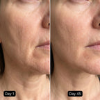 LED Cell Renewal Mask