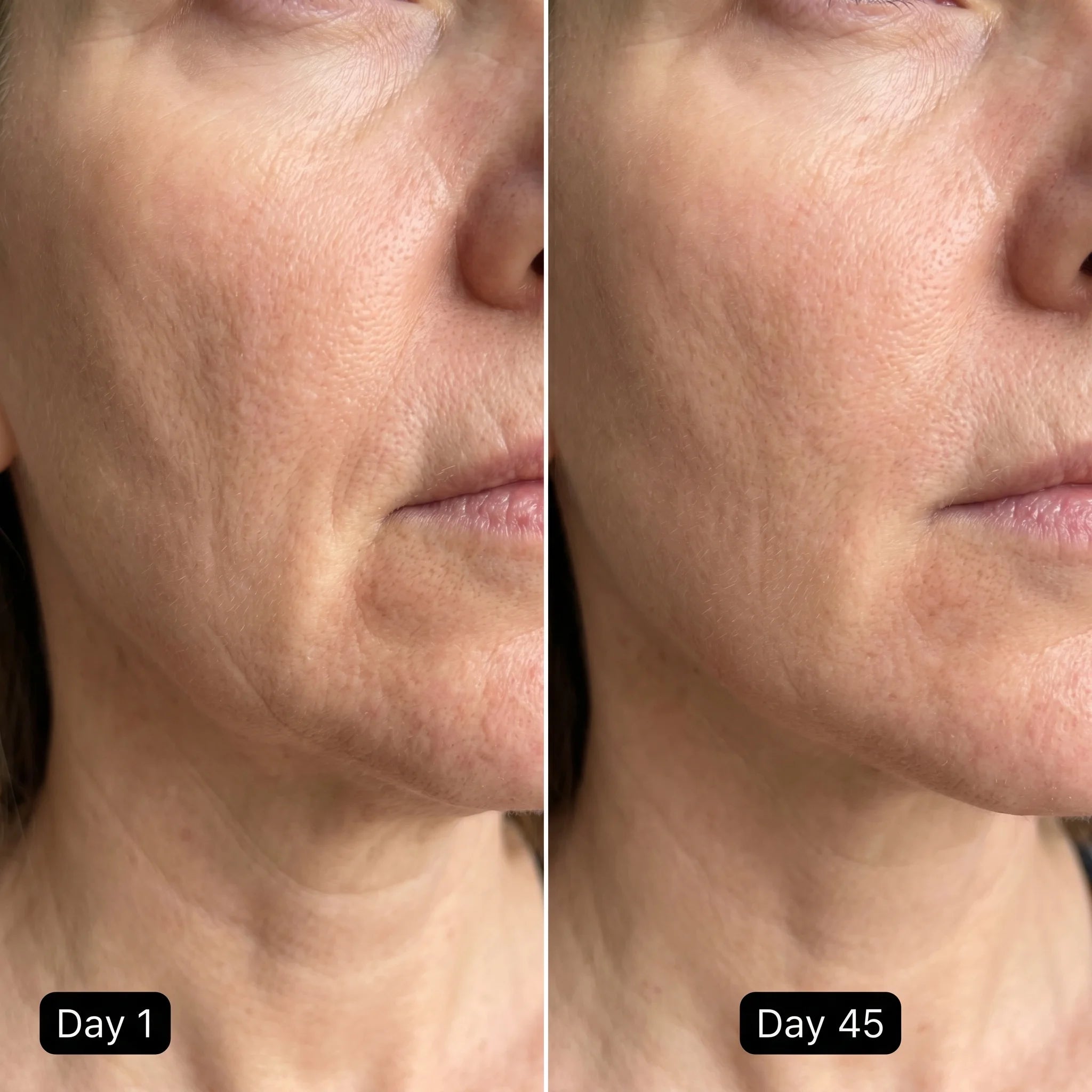 LED Cell Renewal Mask